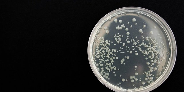 Listerien sind stäbchenförmige Bakterien. Eine Kontamination von Lebensmittel mit diesen Krankheitserregern kann man weder von Auge sehen, noch riechen. (Symbolbild Pixabay)
