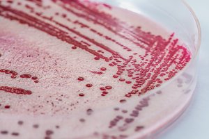 Um Listerien nachzuweisen, werden die Bakterien aus einer Probe kultiviert. Von Auge sehen oder riechen kann man eine Kontamination von Lebensmitteln mit Listerein nicht. (Bild Adobe Stock)