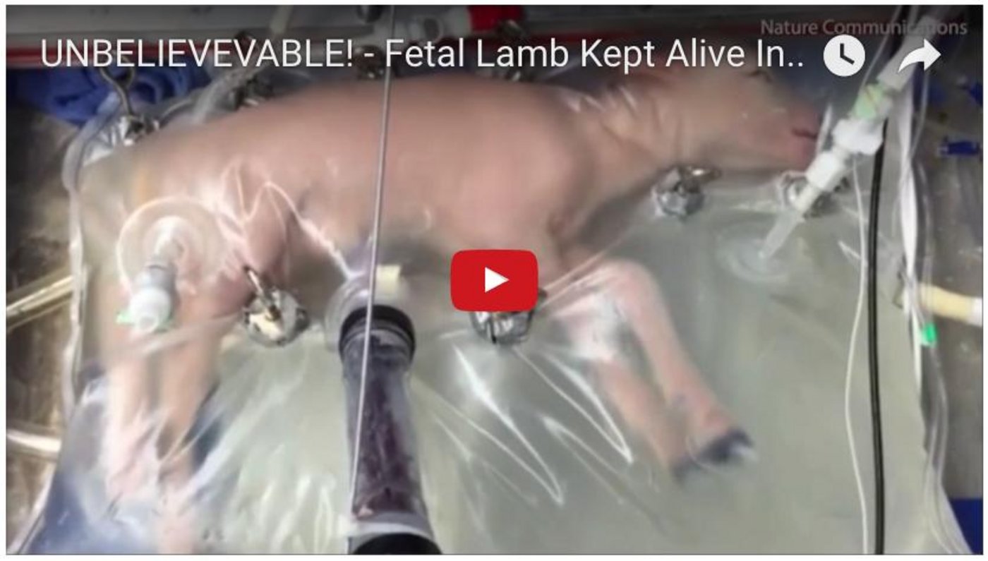 Dereinst sollen auch frühgeborene Babys im Kunstoffbeutel heranwachsen können. (Screenshot Youtube)