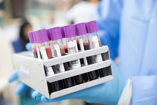 BLV: Die häufigsten Zoonosen 2019 Im letzten Jahr wurden 7000 Campylobacteriose-Fälle und 1500 Salmonellose-Fälle gemeldet. (Bild Ahmad Ardity/pixabay)