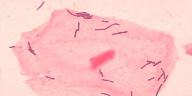 Bei der Agroscope kommen zu Forschungszwecken Milchsäurebakterien zum Einsatz. (Bild: PD-USGov-HHS-CDC)