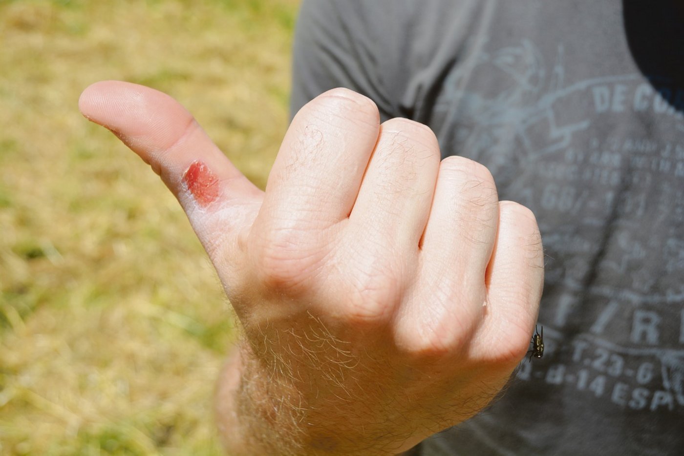 Die Arbeit an der Schaufel hat gleich am ersten Tag Spuren hinterlassen.