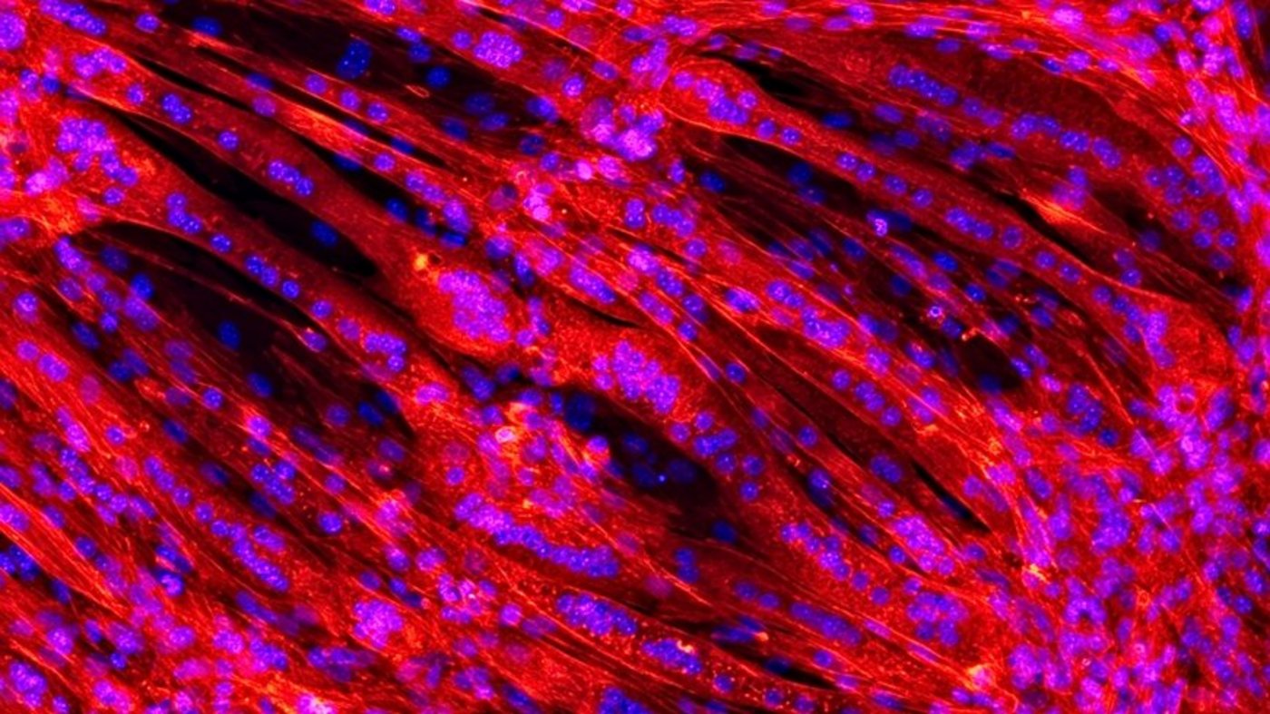 Der Natur nachgeahmt: Ein Geflecht aus Muskelfasern (rot) wächst auf einem Gerüst auf gesponnenem Kunststoff. Das Blaue sind Zellkerne. (Bild Lukas Weidenbacher