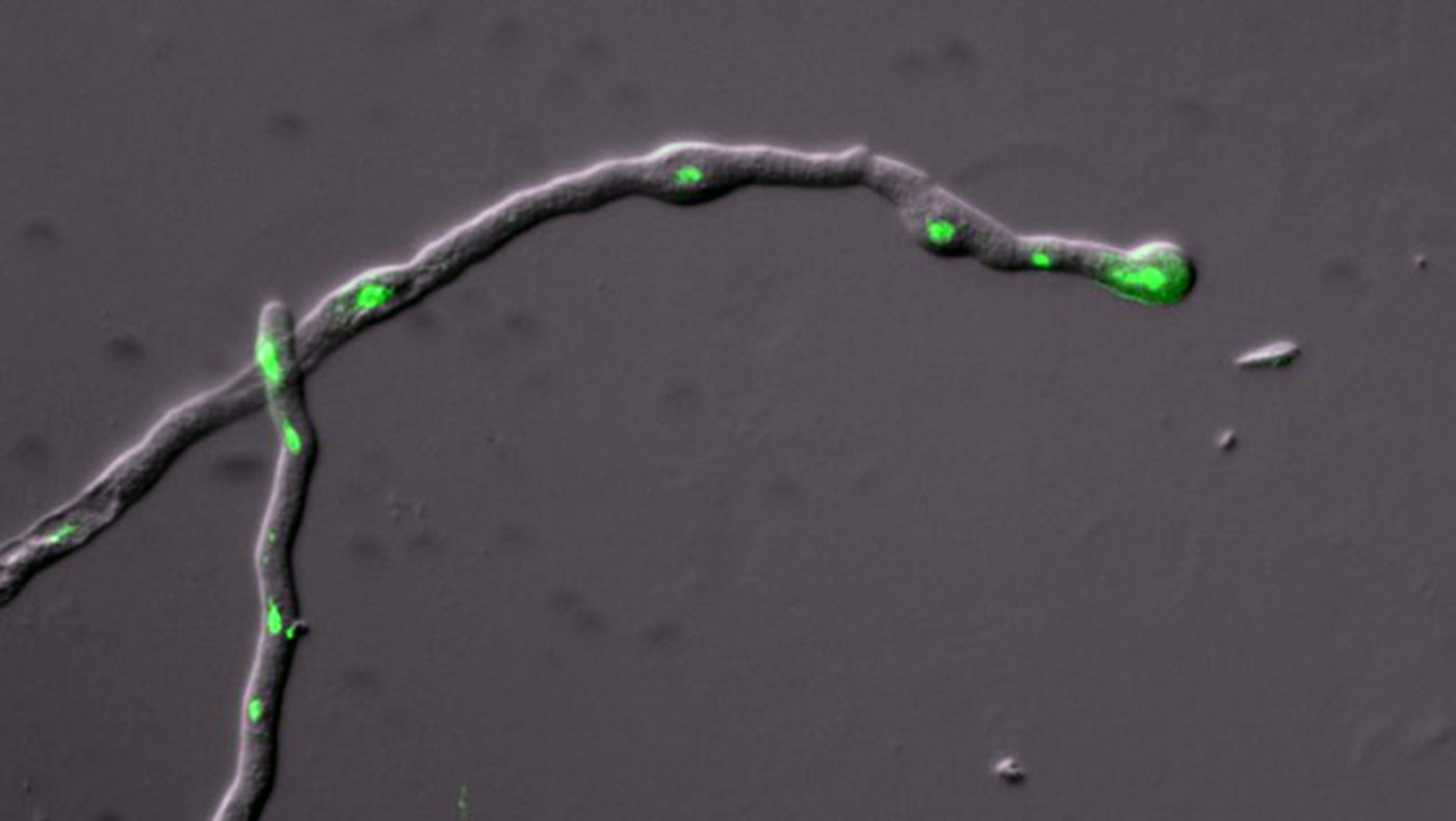 Pollenschläuche mit fluoreszenz-markierten Signalstoffen. (Bild UZH)