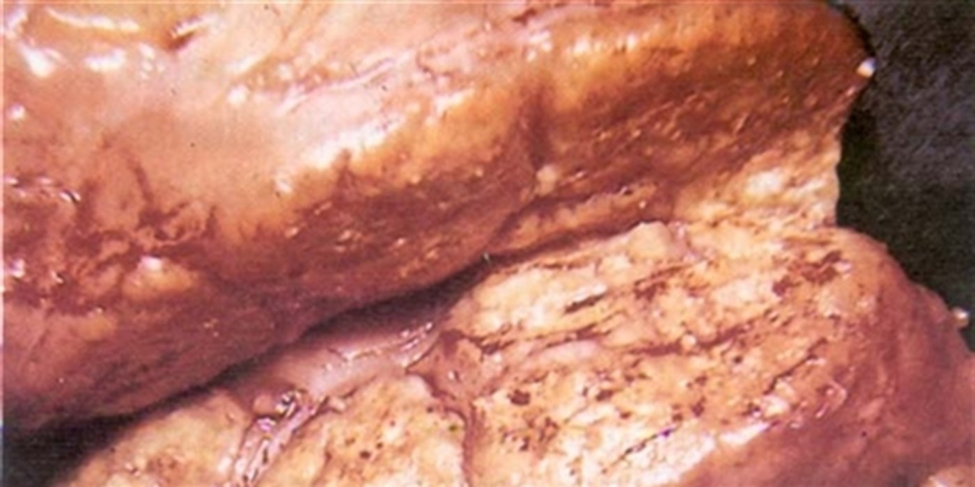  Tuberkulose-Granulom in den Lymphknoten eines Rinds. (Bild fao.org) 