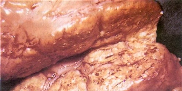  Tuberkulose-Granulom in den Lymphknoten eines Rinds. (Bild fao.org) 