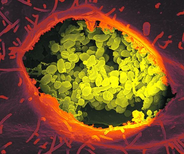 Das auf dem Bild stark vergrösserte Bakterium Coxiella brunetii kann sowohl Menschen als auch Tiere befallen. (Bild Georg Graf von Westphalen)