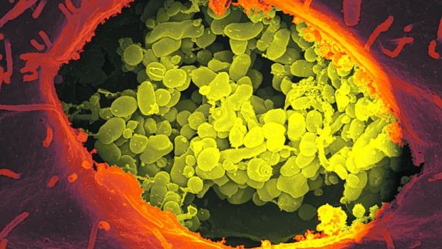 Das auf dem Bild stark vergrösserte Bakterium Coxiella brunetii kann sowohl Menschen als auch Tiere befallen. (Bild Georg Graf von Westphalen)