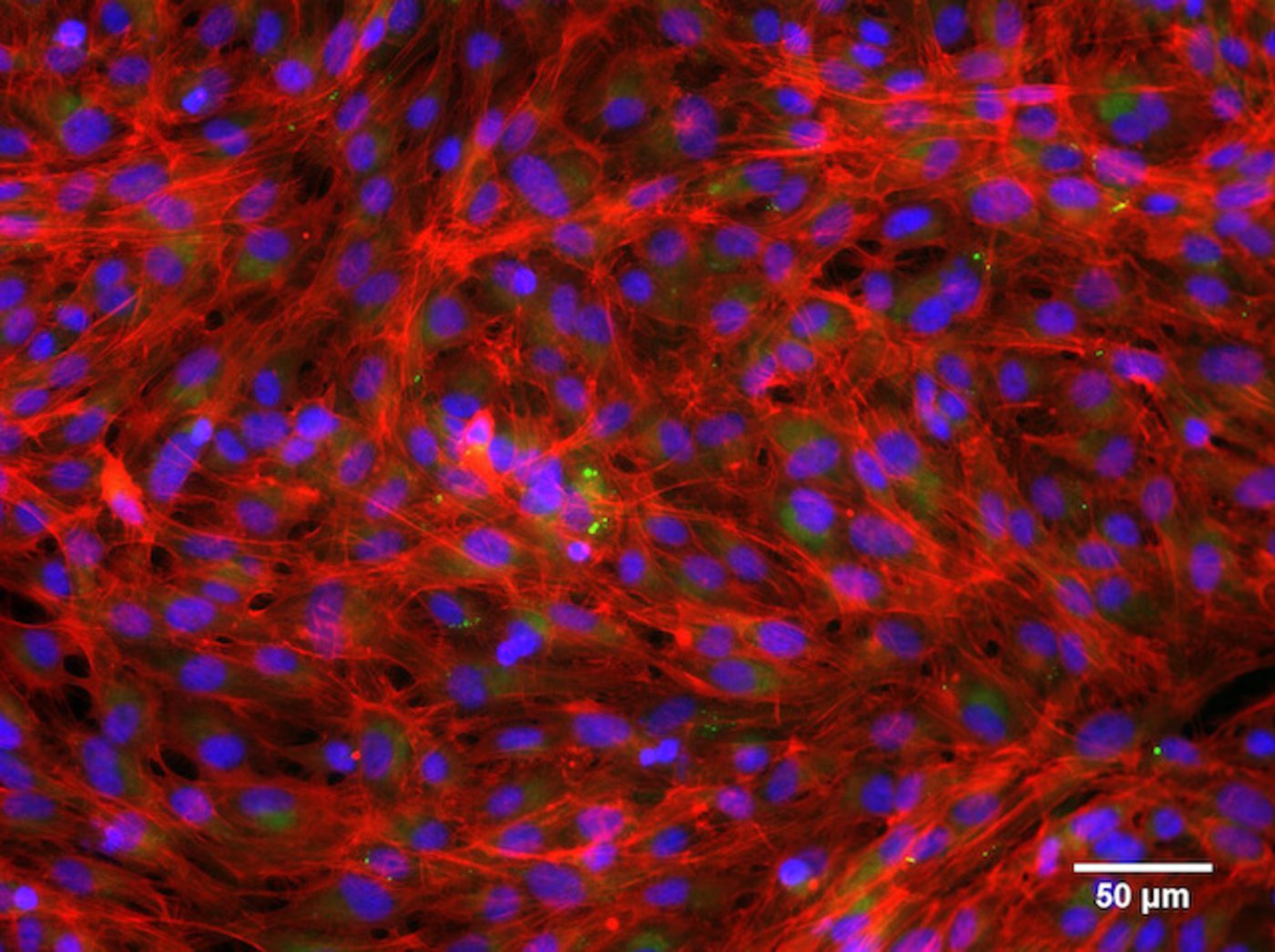Angefärbte, gesunde Kiemenzellen von Regenbogenforellen: Zellkerne (blau), Lipide (grün), Aktin (rot). (Bild Eawag)