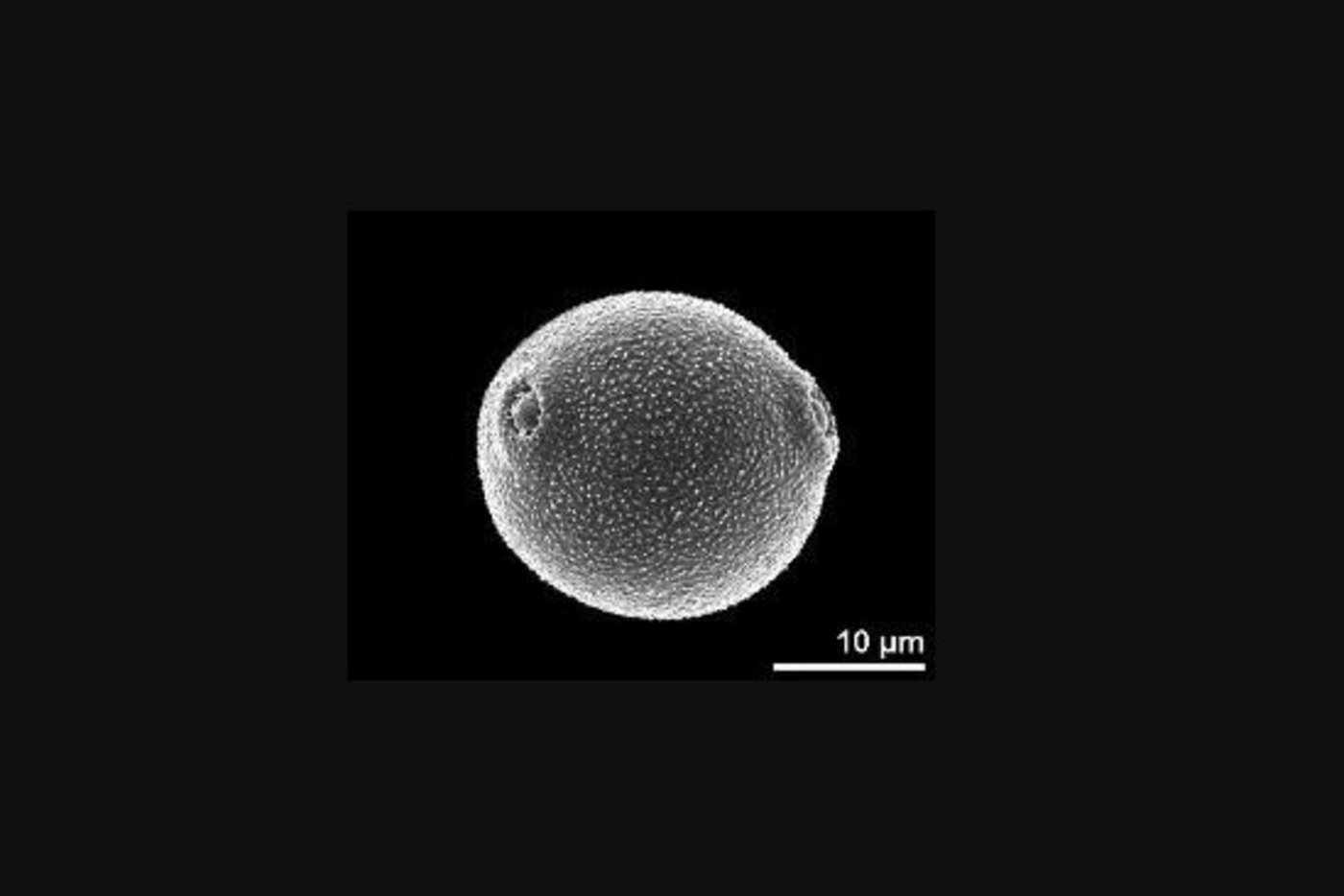 Pollenkörner sind wahre Kunstwerke. Jede Pflanzenart produziert ihre ganz eigene, charakteristische Form. (Bild PalDat.org)