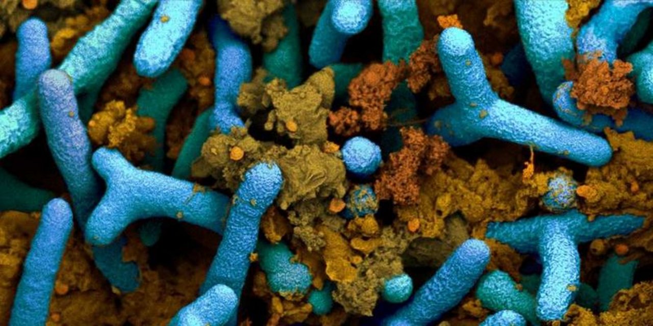 Knöllchenbakterien (blau) in einer Pflanzenwurzel. Braun sichtbar sind pflanzliche Proteine (kolorierte elektronenmikroskopische Aufnahme). (ETH Zürich / Anne Greet Bittermann) 