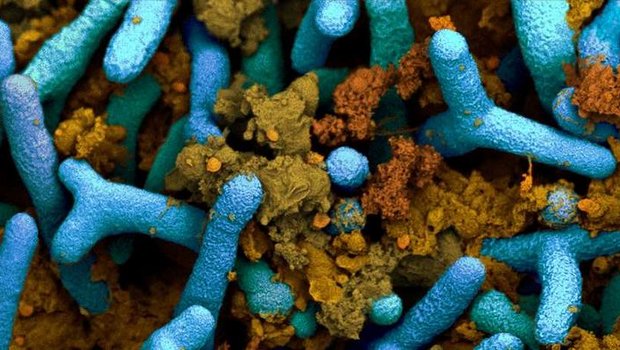 Knöllchenbakterien (blau) in einer Pflanzenwurzel. Braun sichtbar sind pflanzliche Proteine (kolorierte elektronenmikroskopische Aufnahme). (ETH Zürich / Anne Greet Bittermann) 