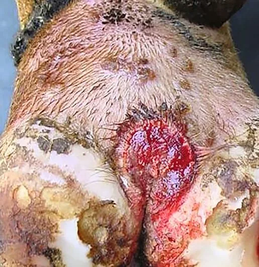 M2: Aktue Veränderung. Ansteckend! Wunde grösser als 2 cm.