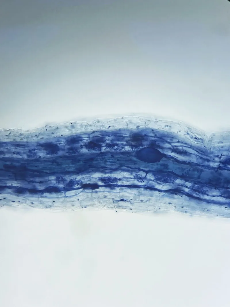 In den Zellen einer Maiswurzel sind Baum-artige blaue Strukturen zu erkennen. Das sind Mykorrhiza-Pilze.